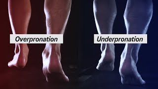 How to Determine your Pronation [upl. by Ameluz684]