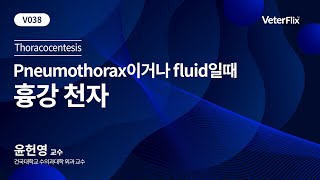 베터플릭스 Pneumothorax이거나 fluid일때  흉강 천자 [upl. by Ateerys919]