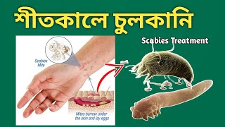 Scabies চুলকানির চিকিৎসা [upl. by Rema80]