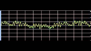 Melanosis  Rife Frequencies [upl. by Nnyrat]