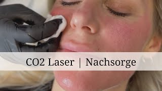 CO2 Laserbehandlung Nachsorge  Dr Ben Gehl [upl. by Zashin784]