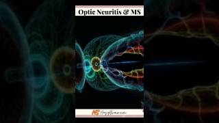 How To Recognize Optic Neuritis And MS [upl. by Lletniuq308]