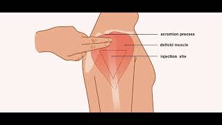 The best site to administer injection on arm deltoid muscle complete step by step detail [upl. by Caesaria]