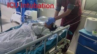 ICU Intubation How to inubate critical patient in ICU [upl. by Rab]