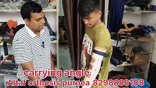 💯 सही होगा Hand elbow carrying angle medical test  elbow problem carrying angle [upl. by Diannne]