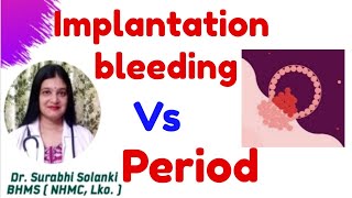 Implantation bleeding vs period  Implantation symptoms  Hindi [upl. by Ahsinned]