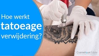 Help een Tattoo Hoe kan je een tatoeage verwijderen [upl. by Aramad]