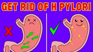 How to Get rid of H Pylori Pain Naturally [upl. by Inness146]