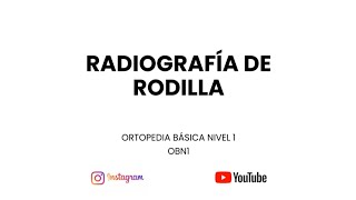 NO LEAS MÁS Rx DE RODILLA SIN VER ÉSTE VÍDEO  Lectura adecuada de la radiografía de rodilla [upl. by Mcnamee]