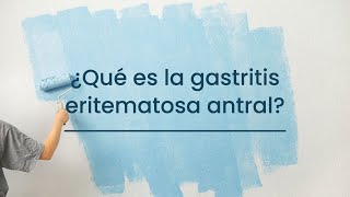 ¿Qué es la Gastritis eritematosa antral [upl. by Wein111]