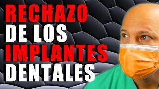 RECHAZO A LOS IMPLANTES DENTALES [upl. by Denver113]