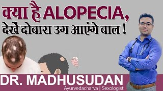 क्या है Alopecia देखें दोबारा उग आएंगे बाल   Hair Regrowth Treatments  Dr Madhusudan [upl. by Nofpets27]