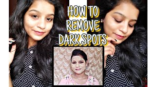 HOW TO REMOVE DARK SPOTS NATURALLY 😍💛 [upl. by Pansir]