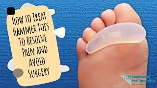 How to Treat Hammer Toes To Resolve Pain and Avoid Surgery [upl. by Tamanaha]