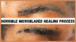 Watch this before you consider microblading your eyebrows  Microblading eyebrows healing process [upl. by Eggleston317]