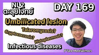 ตะลุยโจทย์ NL2 คละโจทย์ DAY 169 “Umbilicated papule in HIV patients” MedSalmon ติว NL by พี่ซี [upl. by Granger95]