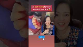 Teeth Cleaning se Daant khrab hote h  dentalscaling scaling teethcleaning shorts doctor [upl. by Evot]