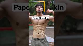 Paper thin skin youtubeshorts ytshorts paperthin shorts [upl. by Atneciv]