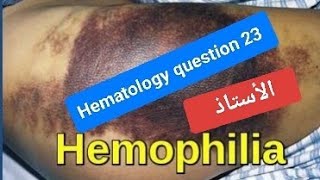 Hematology question 23 Hemophilia [upl. by Okeim]