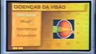 Doenças da Visão  parte1 [upl. by Eibur]