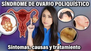 Síndrome de Ovario Poliquístico Causas SÍNTOMAS y TRATAMIENTO 👩🏻‍⚕️l Dra Pau Zúñiga [upl. by Kcoj]