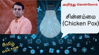 தெரிந்து கொள்வோம்  சின்னம்மை Chicken Pox தமிழில் [upl. by Rhoads]