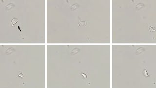 FallingLeaf Motility of Giardia lamblia and A Giardia lamblia Trophozoitewith FallingLeaf Motility [upl. by Woodruff]