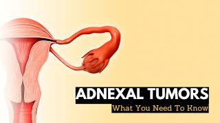 Adnexal Tumors What You Need To Know [upl. by Hugues214]