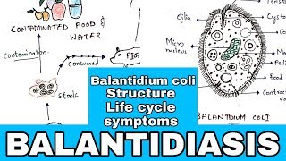 Balantidiasis  Balantidium coli Structure Life cycle Symptoms Medication  Bio science [upl. by Ened61]