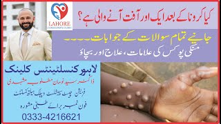 All About Monkey Pox  Symptoms Preventions and Treatment by Dr Syed Noman Mutloob [upl. by Mouldon49]