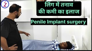 Penile Implant In Mumbai Bangalore Hyderabad Kolkata Lucknow Surat Ahmedabad Bhopal Jaipur Jodhpur [upl. by Brabazon]