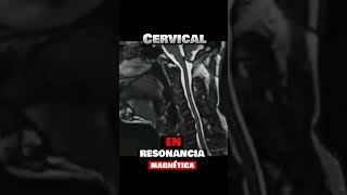 ⚡Cervicales En RESONANCIAFlexión y extensión del cuello [upl. by Ainerol273]