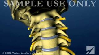 Cervical Spine and Intervertebral Disc Anatomy  Female Version [upl. by Atteve]