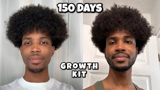 Trying To Grow A Beard In 150 Days  The Beard Growth Kit  The Hair Growth Kit By CPH Grooming [upl. by Lenoj558]