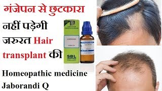 How to use Jaborandi Q Mother tincture in Alopecia amp Hair fall  Top Homeopathic medicine  Hindi [upl. by Nuavahs]