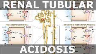 Renal Tubular Acidosis [upl. by Lovash70]