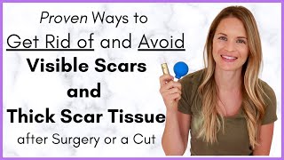 Proven Ways to Heal a Scar Quickly  Avoiding Scar Tissue after Surgery  By a Physical Therapist [upl. by Milton]