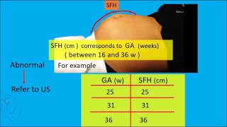 Symphysis Fundal Height  SFH  measurement [upl. by Owain]