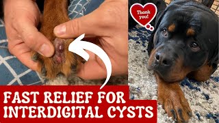 Fast Relief For Interdigital Cysts [upl. by Noit345]