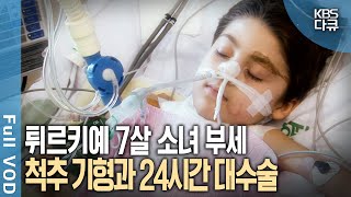 선천적 척추 기형 12시간 장거리 비행 24시간 대수술 마지막 희망을 안고 한국에 온 7살 튀르키예 소녀 부세  현장기록 병원  KBS 20070121 방송 [upl. by Meehsar]