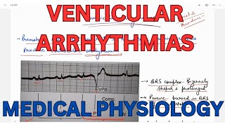 Ventricular Arrhythmias Tachycardiafibrillation Telegram httpstmedrshikhasaxenahumanphysiology [upl. by Brothers937]