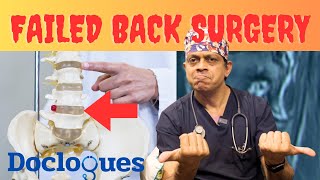 Failed Back Surgery Syndrome [upl. by Dodson]