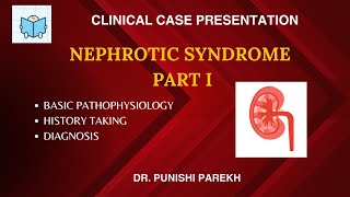 Clinical Case presentation on Nephrotic Syndrome  Part 1 [upl. by Oswell136]