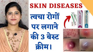 Top 3 Ointments for all Skin Diseases ॥ त्वचा रोगों पर लगाने के बेस्ट 3 क्रीम ॥ [upl. by Elletsyrk]