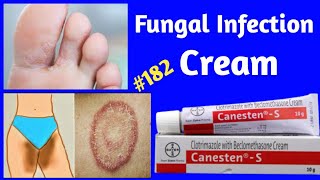 Candid B Cream For Fungal Infection  Clotrimazole And Beclomethasone Cream  Canesten S Cream [upl. by Chak]