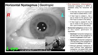 Nystagmus EXPLAINED 👀  Visualizing amp Interpretation [upl. by Ennovart373]