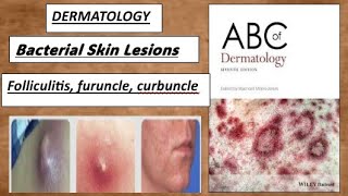 DERMATOLOGY  Bacterial skin lesion  folliculitis furunclecurbuncle derma lesion [upl. by Ahsinit349]