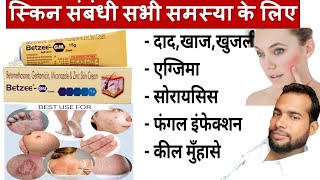 मात्र 5 दिन मे दाद खाज खुजली जड़ खत्म ।। dad khaj khujali ki dava ।। Betzee gm cream uses Hindi [upl. by Sitnik]