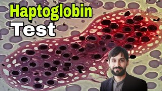 Haptoglobin Test  Haptoglobin Blood Test  MLT Hub with kamran [upl. by Suhsoj]