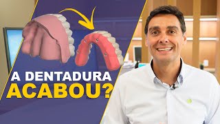 Protocolo o Incrível Substituto da Dentadura [upl. by Aicenek701]